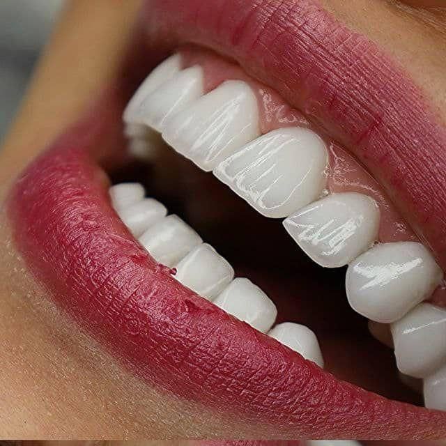 ایمپلنت .کامپوزیت. و تمامی خدمات دندانپزشکی