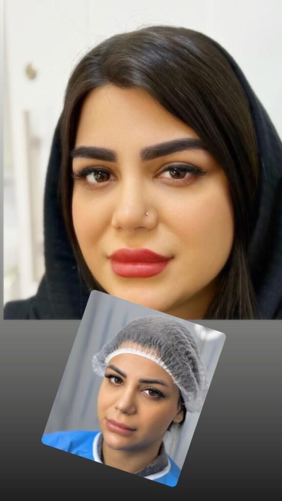 جشنواره ویژه کاشت ابرو